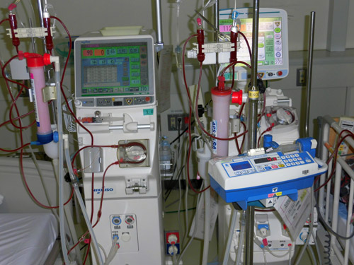 血液透析の様子の写真