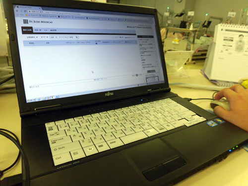 ペースメーカーのデータ