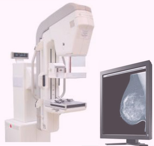 マンモグラフィー